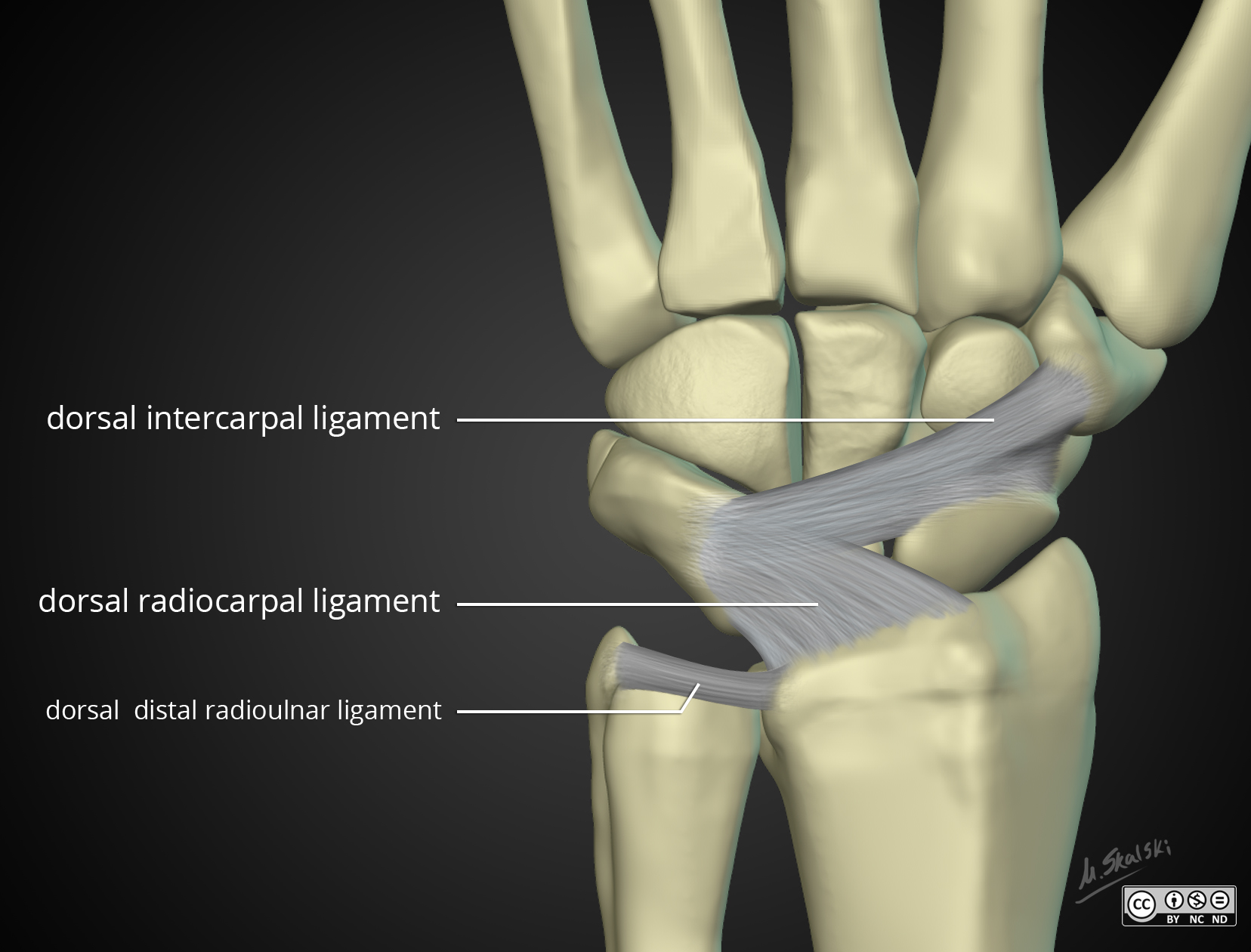 radiopaedia-drawing-extrinsic-ligaments-of-the-wrist-dorsal-view